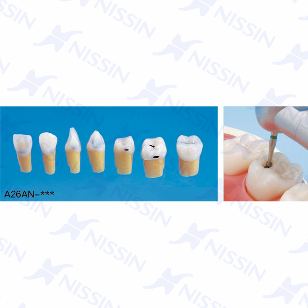 帶齲齒的復(fù)合樹脂牙