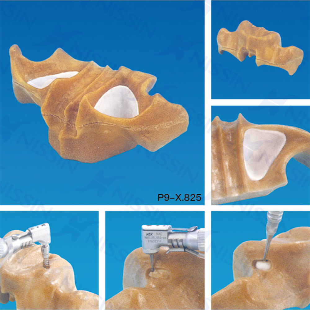 上頜竇底提升實習用模型
